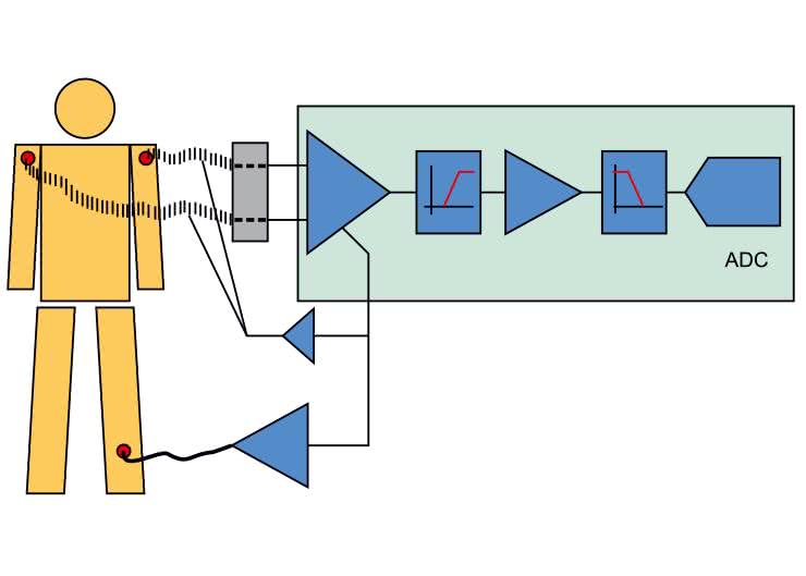 Praktyczne aplikacje scalonych układów AFE (3). Przegląd układów AFE do akwizycji sygnałów bioelektrycznych